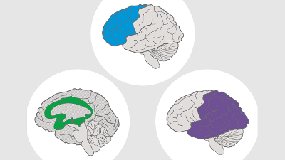 Illustration of three UDL brain networks: affective, recognition, strategic